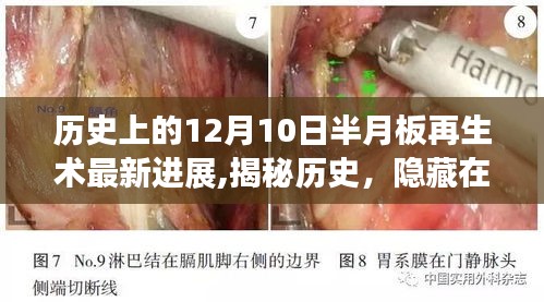 揭秘历史，医学奇迹之旅——半月板再生术创新小店的秘密历程（12月10日最新进展）