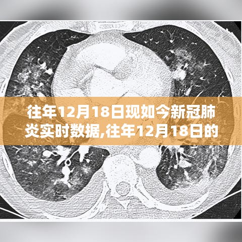 往年12月18日新冠肺炎实时数据回顾，疫情形势分析与当前状况展望