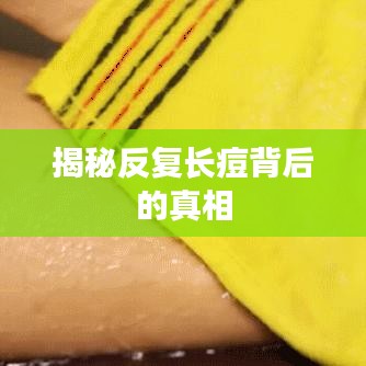 揭秘反复长痘背后的真相