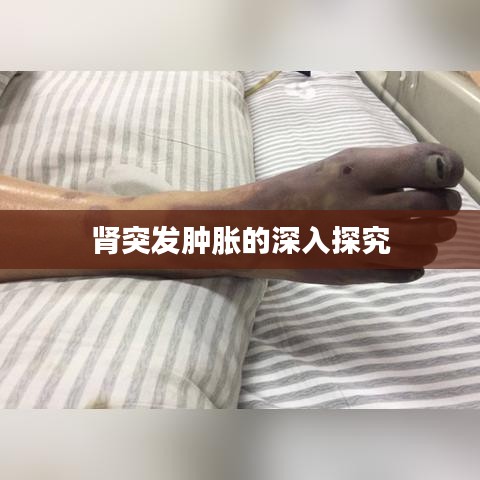 肾突发肿胀的深入探究