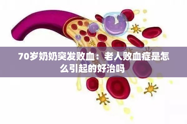 70岁奶奶突发败血：老人败血症是怎么引起的好治吗 