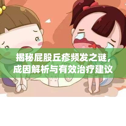 揭秘屁股丘疹频发之谜，成因解析与有效治疗建议！