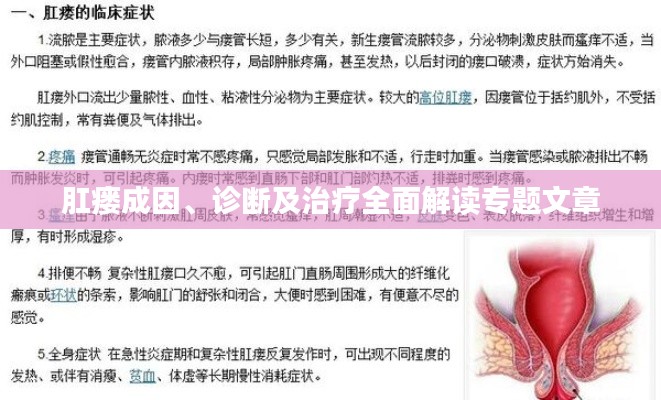 肛瘘成因、诊断及治疗全面解读专题文章