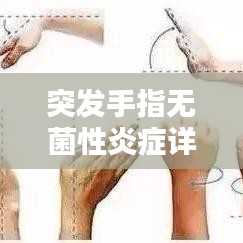 突发手指无菌性炎症详解，原因、治疗与预防措施