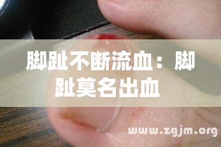 脚趾不断流血：脚趾莫名出血 