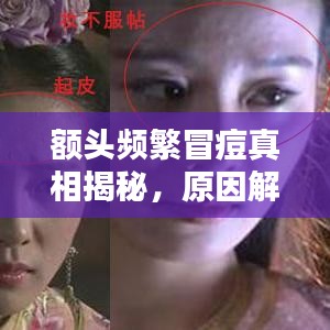 额头频繁冒痘真相揭秘，原因解析与应对方法