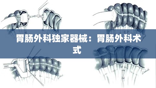 胃肠外科独家器械：胃肠外科术式 