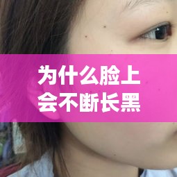 为什么脸上会不断长黑点：为什么脸上会长一些小黑点 