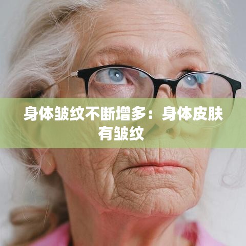 身体皱纹不断增多：身体皮肤有皱纹 