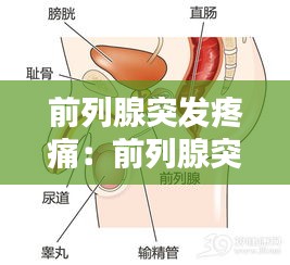 前列腺突发疼痛：前列腺突然疼痛一会又好了 