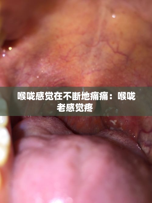 喉咙感觉在不断地痛痛：喉咙老感觉疼 