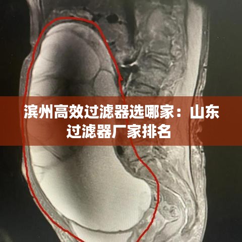 滨州高效过滤器选哪家：山东过滤器厂家排名 