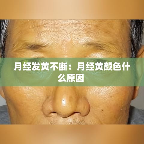 月经发黄不断：月经黄颜色什么原因 