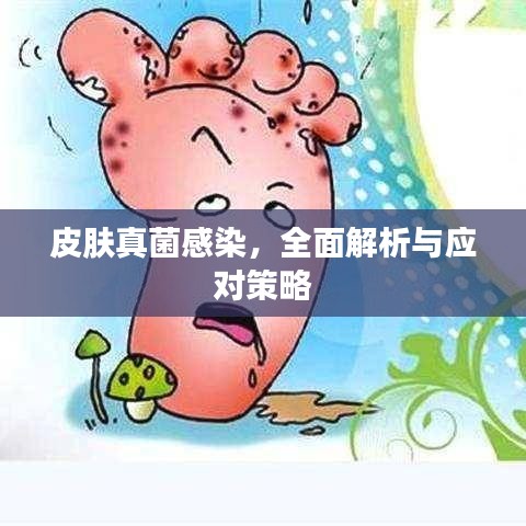 皮肤真菌感染，全面解析与应对策略