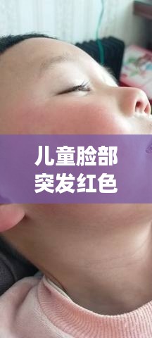 儿童脸部突发红色硬结，全方位了解、预防与治疗指南
