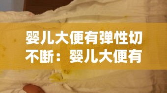 婴儿大便有弹性切不断：婴儿大便有软条形的东西是什么 