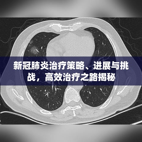 新冠肺炎治疗策略、进展与挑战，高效治疗之路揭秘