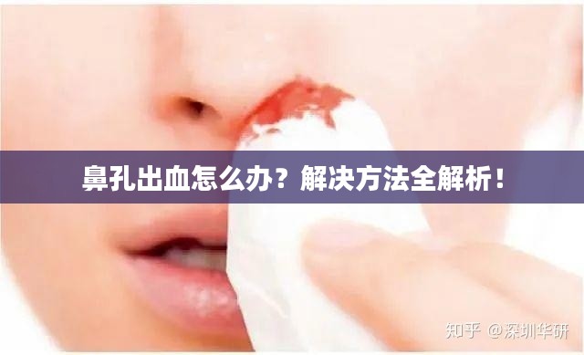 鼻孔出血怎么办？解决方法全解析！