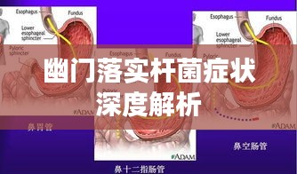 幽门落实杆菌症状深度解析