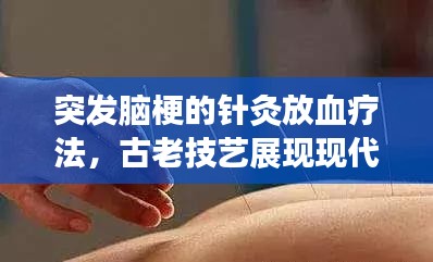 突发脑梗的针灸放血疗法，古老技艺展现现代神奇效果