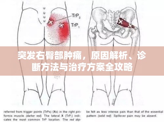 突发右臀部肿痛，原因解析、诊断方法与治疗方案全攻略