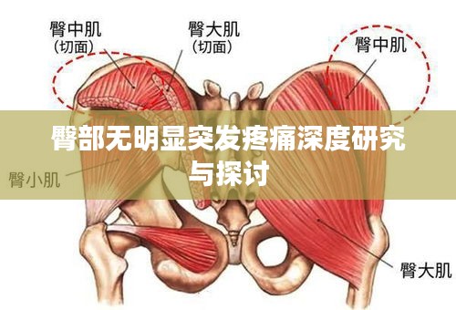 臀部无明显突发疼痛深度研究与探讨