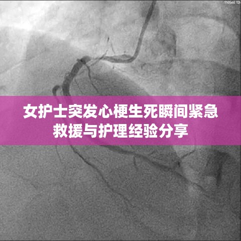 女护士突发心梗生死瞬间紧急救援与护理经验分享