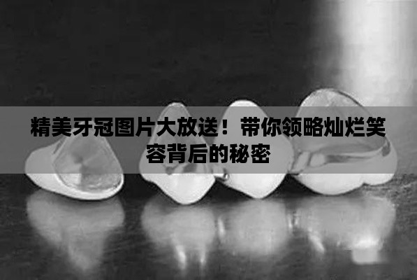 精美牙冠图片大放送！带你领略灿烂笑容背后的秘密